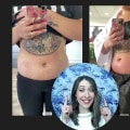 Recovery Time After Cool Sculpting: What You Need to Know