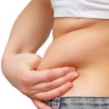 The Risks of Unnatural Appearance from Cool Sculpting