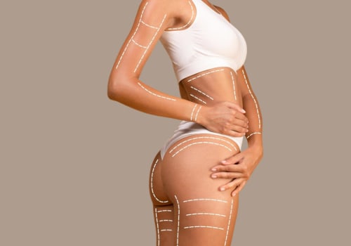 Combining Cool Sculpting with Other Procedures: A Comprehensive Guide