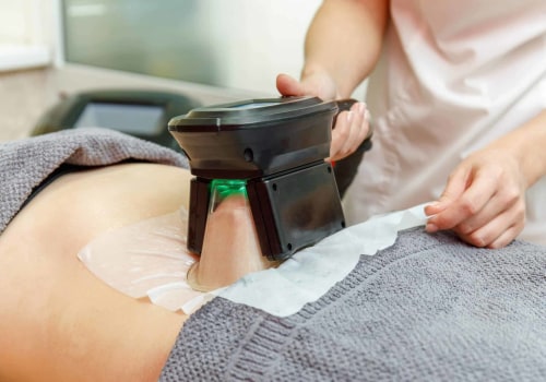 Ensuring the Safety of Your Cool Sculpting Treatment