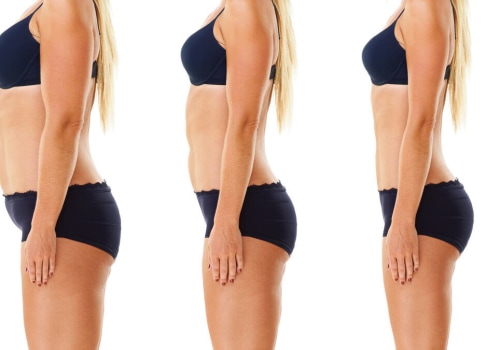 Exploring Reviews from Patients with Similar Body Types for Cool Sculpting