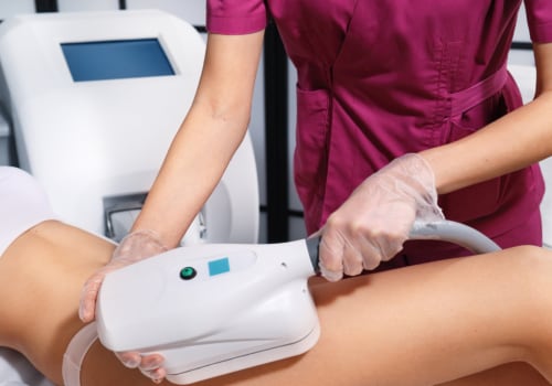 How Much Does Cool Sculpting Cost? A Comprehensive Guide to Non-Invasive Body Contouring