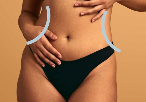 Is Cool Sculpting Covered by Insurance? A Comprehensive Guide for Your Body Transformation