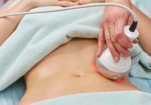 The Advantages of Non-Surgical Body Contouring