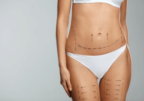 Choosing the Right Body Contouring Technique for Your Desired Results